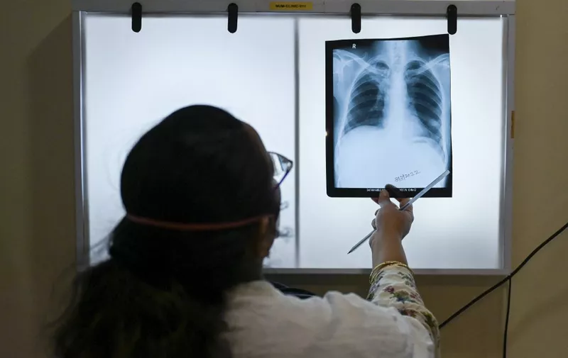 In this picture taken on March 22, 2022, a doctor checks Gautam Kamble's chest x-rays, who is diagnosed with tuberculosis, during a routine consultation at the Médecins Sans Frontières (MSF) clinic, which treats people with drug-resistant tuberculosis, in Mumbai. When Covid-19 ripped through India in 2020-21, several million people are thought to have died. Desperate efforts to stem the pandemic hurt the battle against another huge killer: tuberculosis. (Photo by Punit PARANJPE / AFP) / TO GO WITH India-Health-tuberculosis-vaccine,FOCUS by Glenda KWEK