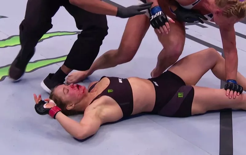 16 November 2015 &#8211; MELBOURNE &#8211; AUSTRALIA **** STRICTLY NOT AVAILABLE FOR USA USAGE *** ACTRESS/MMA FIGHTER AND UNDEFEATED WOMEN&#8217;S BANTAMWEIGHT CHAMPION RONDA ROUSEY IS KNOCKED OUT BY 20 TO 1 UNDERDOG HOLLY HOLM AT UFC 193 IN MELBOURNE AUSTRALIA. RONDA ROUSEY HAD BEEN LAUDED AS THE GREATEST FEMALE FIGHTER EVER, BUT WAS KNOCKED OUT [&hellip;]