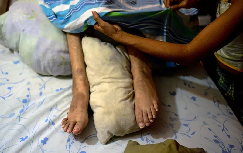 Ana Barrios, takes care of her quadriplegic husband Marco Guillen, at their house in Barquisimeto, Lara state, Venezuela on October 23, 2017. Marco Guillen became quadriplegic in an accident twelve years ago, amid Venezuela's deep economical crisis he desperately asks President Maduro's government to help him to live with dignity, meeting his medical necessities otherwise he pleads for euthanasia. (Photo by FEDERICO PARRA / AFP) / TO GO WITH AFP STORY by MARGIONI BERMUDEZ