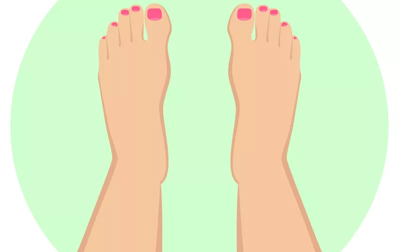Female feet with nail polish