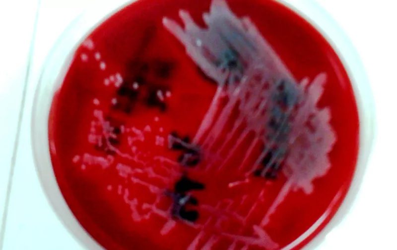 MRSA Methicillin Resistant Staphylococcus aureus