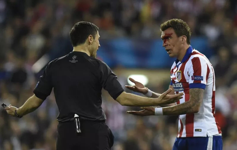 Atletico Madrid&#8217;s Croatian forward Mario Mandzukic (R) bleeds as he argues with the referee during the UEFA Champions League quarter final first leg football match Atletico de Madrid vs Real Madrid CF at the Vicente Calderon stadium in Madrid on April 14, 2015. AFP PHOTO / PIERRE-PHILIPPE MARCOU