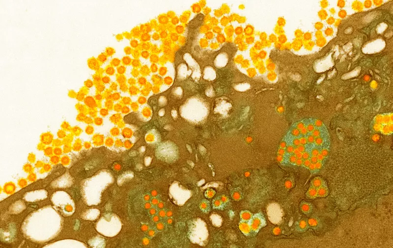 Novel coronavirus 2012. Coloured transmission electron micrograph (TEM) of coronavirus particles (orange) budding from a host cell (brown). This virus (NCoV) is thought to be similar to the ones that cause SARS (severe acute respiratory syndrome). A SARS-like virus killed hundreds in 2002 and 2003. This new virus, which first emerged in 2012, is being tracked by the World Health Organisation (WHO), with 11 confirmed cases as of mid-February 2013. The genetic sequence of the virus is being studied by the UK's Health Protection Agency. Magnification: x30,000 when printed at 10 centimetres wide., Image: 161044737, License: Rights-managed, Restrictions: , Model Release: no, Credit line: Science Photo Library / Sciencephoto / Profimedia