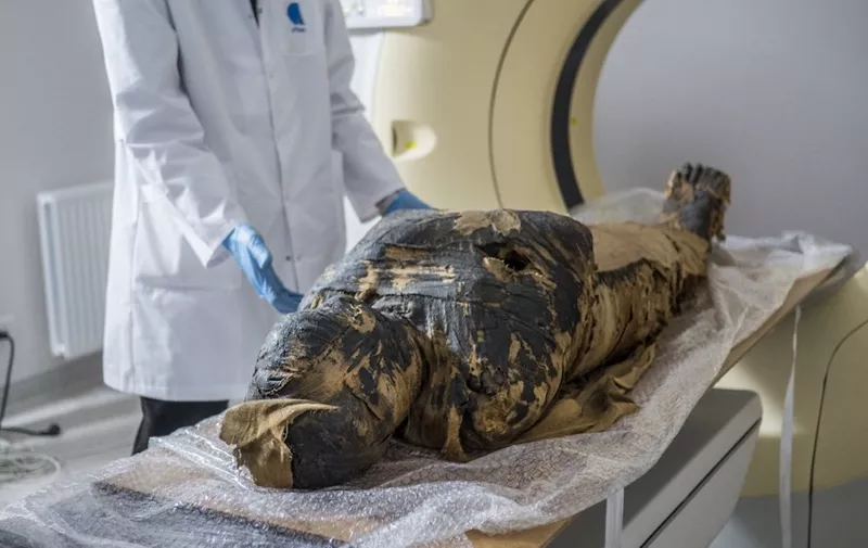 This Handout picture made available by the "Warsaw Mummy Project" on April 29, 2021 shows   the pregnant Egyptian mummy being prepared for X-Ray images taken on December 15, 2015 at a medical centre in Otwock near Warsaw, Poland. - Polish scientists said on April 29, 2021 they have discovered the world's first pregnant Egyptian mummy while carrying out scans on the 2,000-year-old remains kept at the National Museum in Warsaw. (Photo by Aleksander LEYDO / Warsaw Mummy Project / AFP) / RESTRICTED TO EDITORIAL USE - MANDATORY CREDIT "AFP PHOTO / Warsaw Mummy Project / Aleksander LEYDO" - NO MARKETING - NO ADVERTISING CAMPAIGNS - DISTRIBUTED AS A SERVICE TO CLIENTS
