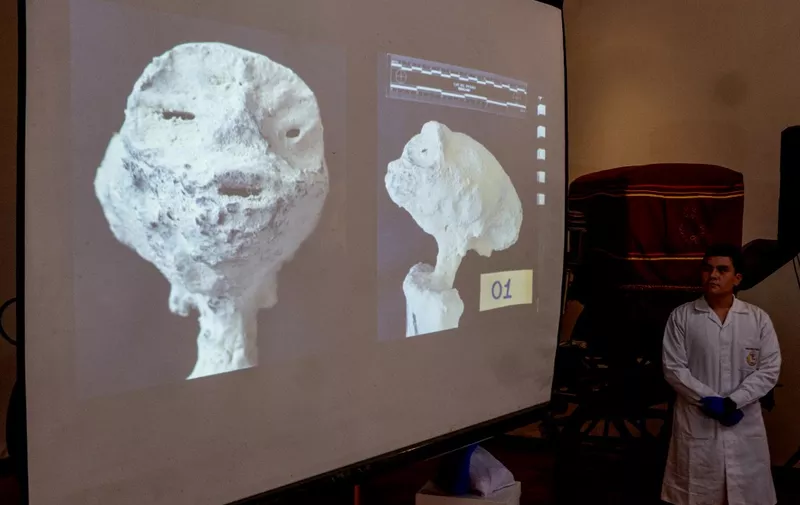 X-ray images are shown to the press of what was believed to be remains of an extraterrestrial alien during a press conference where forensic experts rule out the existence of alleged extraterrestrial mummies or remains of mummies found in the south of the country, during a report presented to the press in Lima on January 12, 2024. The Ministry of Culture described as fraud the story of the supposed extraterrestrial origin of the Nazca mummies that the Mexican Congress exhibited as if they were aliens, after presenting on Friday a forensic report from the prosecution that closes a three-month investigation. (Photo by Cris BOURONCLE / AFP)