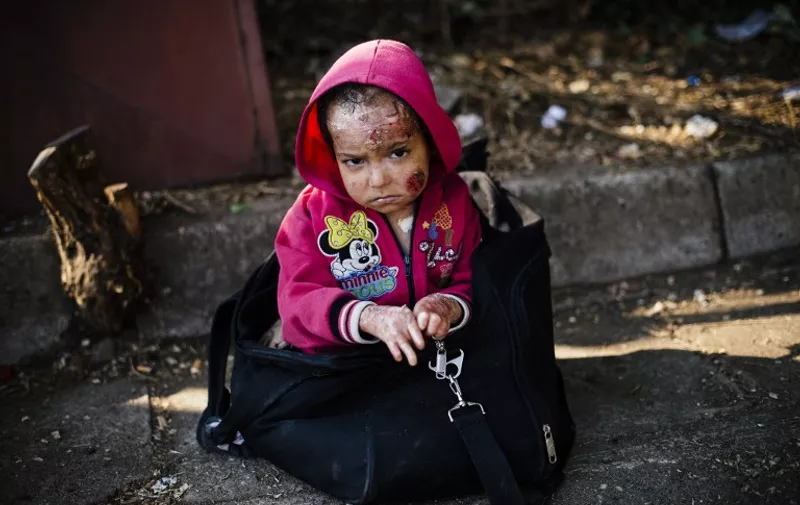 A Syrian child injured from a chemical attack according to her father, waits to reach a train heading to the border with Serbia at the train station in Gevgelija, on the Macedonian-Greek border on August 4, 2015. Many migrants try to cross Macedonia and Serbia to enter the European Union via Hungary, a country that will finish building its anti-migrant fence on its southern border with Serbia by August 31, ahead of a previous November deadline AFP PHOTO / DIMITAR DILKOFF