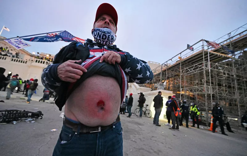 Washington, DC - 010620  A man shows where he was allegedly shot by US Capitol Police officers after they were trying to get control of the buidling on a day where thousands of pro- Trump supporters rallied on January 6, 2021 in the District of Columbia (DC) outside the US State Capitol as the US Senate certificated the Electoral College vote ratifying Joe Biden as the president of the US.  (Essdras M Suarez/ ZUMA Press)