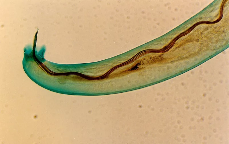 Parazitski crv kroz mikroskop