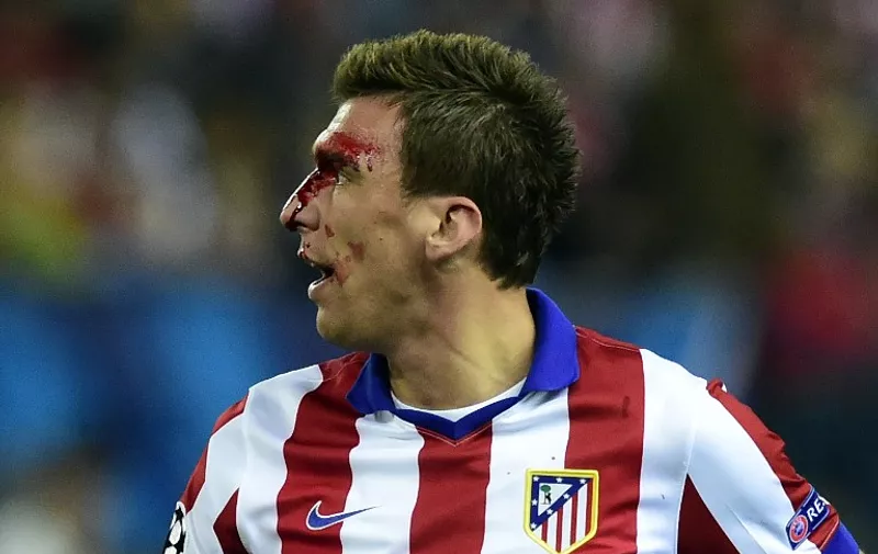 Atletico Madrid&#8217;s Croatian forward Mario Mandzukic bleeds after being injured during the UEFA Champions League quarter final first leg football match Atletico de Madrid vs Real Madrid CF at the Vicente Calderon stadium in Madrid on April 14, 2015. AFP PHOTO /
