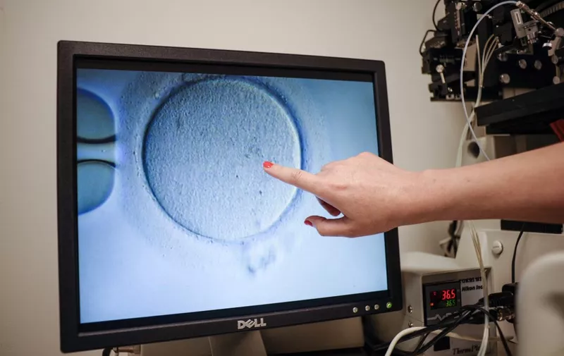 An embryologist shows an Ovocyte after it was inseminated at the Virginia Center for Reproductive Medicine, in Reston, Virginia on June 12, 2019. Freezing your eggs, getting pregnant after the age of 50, choosing the baby's sex: when it comes to in-vitro fertilization and other assisted reproduction procedures in the United States, would-be parents are spoilt for choice. This isn't the case in many other countries, including France, which is hoping to pass legislation that would let single women and lesbian couples benefit from these technologies for the first time. (Photo by Ivan Couronne / AFP) / TO GO WITH AFP STORY by Ivan COURONNE, "In US, relaxed IVF laws help would-be parents realize dreams"