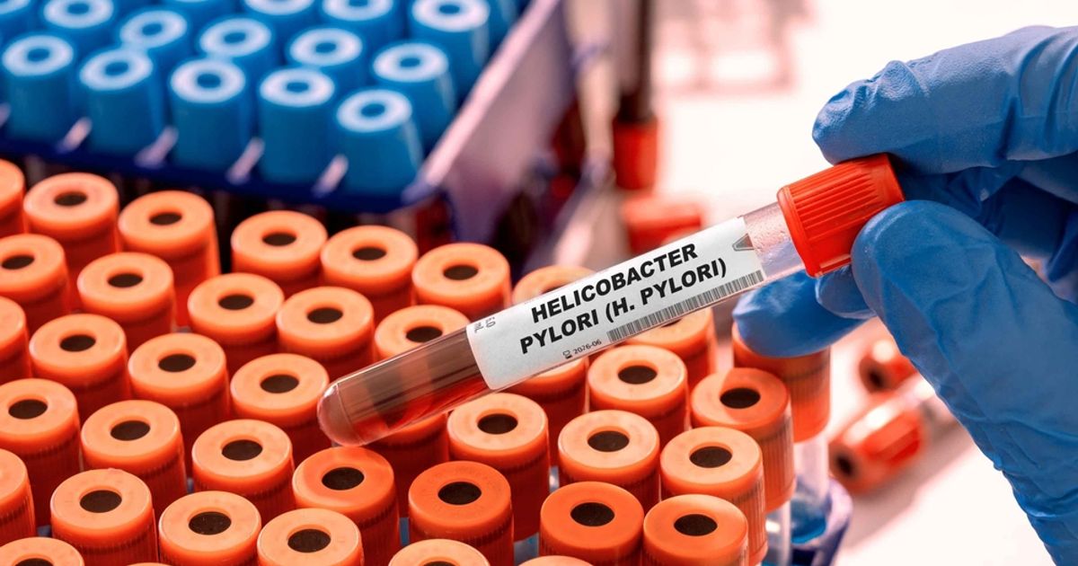 Helicobacter pylori može uzrokovati gastritis, ali i povećati rizik od raka želuca