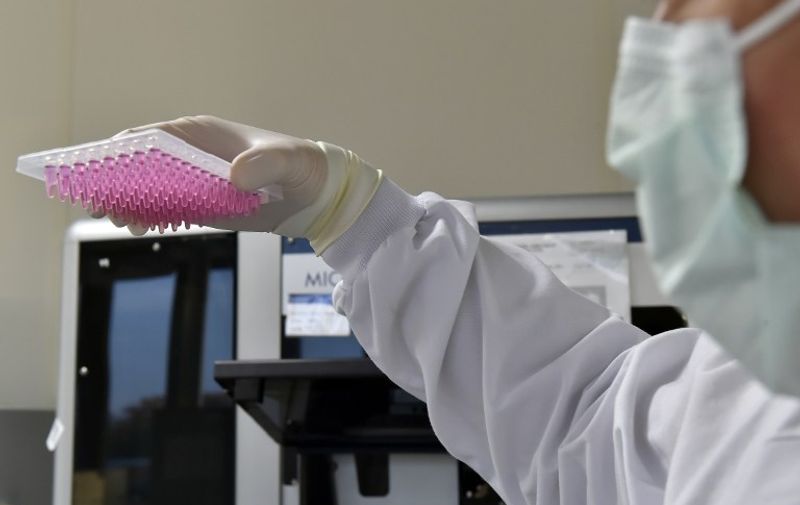 A lab technician handles samples of DNA at the Genetic Institute Nantes-Atlantique (IGNA) on December 10, 2015 in Nantes, western France. 
The Genetic Institute Nantes-Atlantique (IGNA) is one of the first French laboratories of forensic expertise to use DNA evidence to establish the physical characteristics of a suspect and so his "genetic sketch," can be used as a "support tool "  in an investigation. / AFP PHOTO / GEORGES GOBET