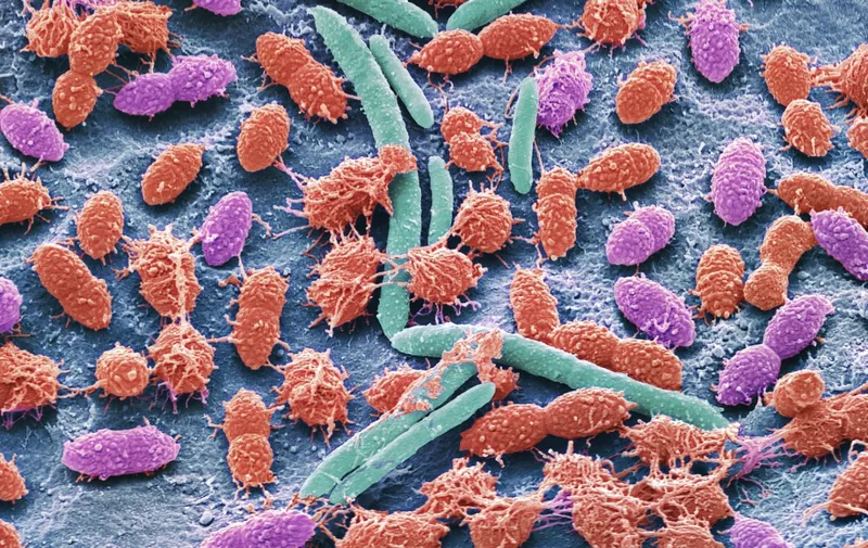 Faecal bacteria. Scanning electron micrograph (SEM) of bacteria cultured from a sample of human faeces. At least 50 per cent of human faeces is made up of bacteria shed from the gut. Many of these bacteria are a normal part of the flora found in the intestines and are beneficial to digestion. However, some are pathogenic, such as Salmonella enterica and certain strains of Escherichia coli, which can cause foodborne illnesses. Magnification: x6000 when printed 10 centimetres wide (Photo by STEVE GSCHMEISSNER/SCIENCE PHOTO / SGS / Science Photo Library via AFP)
