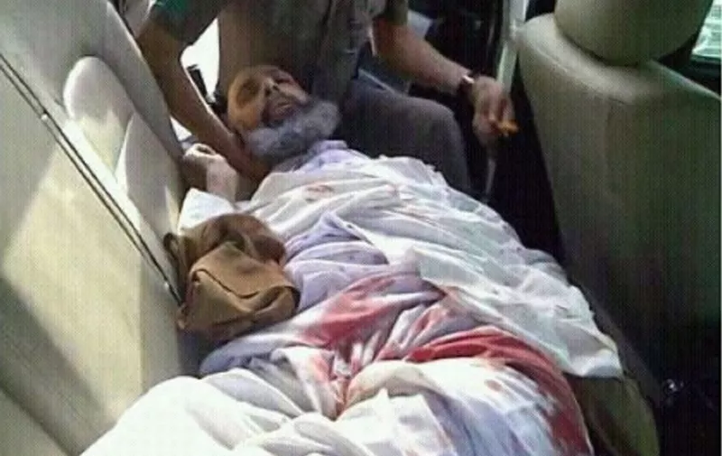 Shiite cleric and goverment critic Sheikh Nimr al-Nimr lies wounded in the back of a police car, following his arrest on July 8, 2012. Two protestors were killed in overnight clashes early July 9 after polce arrested al-Nimr, who they describe as "instigator of sedition", and shot him in the leg as he resisted arrest. AFP PHOTO/STR / AFP / -