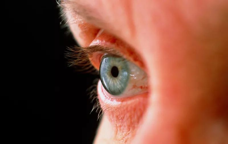 MODEL RELEASED. Elderly woman's eye., Image: 102459765, License: Rights-managed, Restrictions: , Model Release: yes, Credit line: Profimedia, Sciencephoto RM