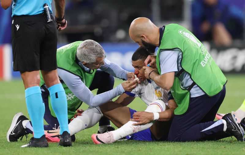 Dusseldorf, Germany, 17th June 2024. Kylan Mbappe of France goes down injured with a broken nose during the UEFA European Championships match at Dusseldorf Arena, Dusseldorf. Picture credit should read: David Klein / Sportimage EDITORIAL USE ONLY. No use with unauthorised audio, video, data, fixture lists, club/league logos or live services. Online in-match use limited to 120 images, no video emulation. No use in betting, games or single club/league/player publications. SPI-3197-0095
