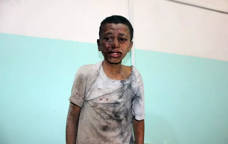EDITORS NOTE: Graphic content / A Yemeni child awaits treatment at a hospital after he was wounded in a reported air strike on the Iran-backed Huthi rebels' stronghold province of Saada August 9, 2018.
A Saudi-led coalition battling in Yemen said it carried out an attack in the rebel-held north today that the Red Cross said hit a bus carrying children, leaving dozens of people dead or wounded. / AFP PHOTO / STRINGER