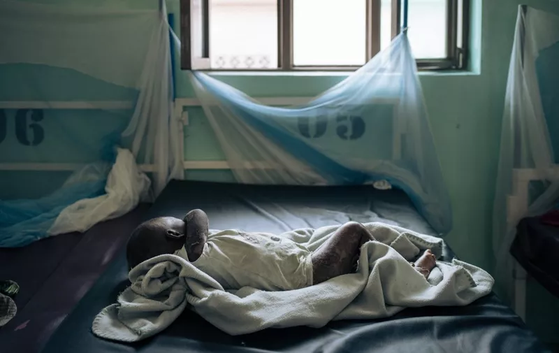 A baby sleeps in the intensive care unit for malnourished children at the Rutshuru hospital in the eastern province of North Kivu, Democratic Republic of Congo, on July 22, 2022. - This unit, supported by MSF (Doctors Without Borders), is more than 130% occupied, and sick children are forced to share beds. Since March, nearly 200,000 people have fled recent fighting on the outskirts of Rutshuru. There has been almost no food distribution for all these displaced people who are living in host families, schools or churches. Children are the first victims of these precarious living conditions. (Photo by ALEXIS HUGUET / AFP)