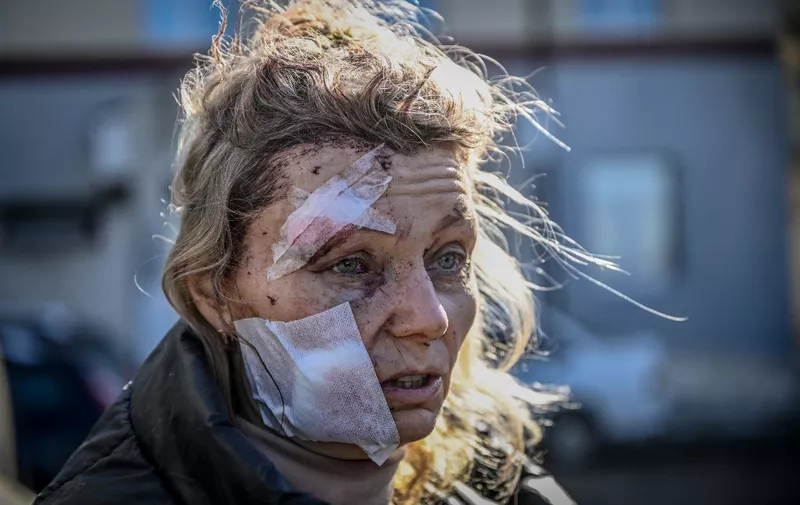 A wounded woman stands outside a hospital after the bombing of the eastern Ukraine town of Chuguiv on February 24, 2022, as Russian armed forces attempt to invade Ukraine from several directions, using rocket systems and helicopters to attack Ukrainian position in the south, the border guard service said. - Russia's ground forces crossed into Ukraine from several directions, Ukraine's border guard service said, hours after President Vladimir Putin announced the launch of a major offensive. Russian tanks and other heavy equipment crossed the frontier in several northern regions, as well as from the Kremlin-annexed peninsula of Crimea in the south, the agency said. (Photo by Aris Messinis / AFP)