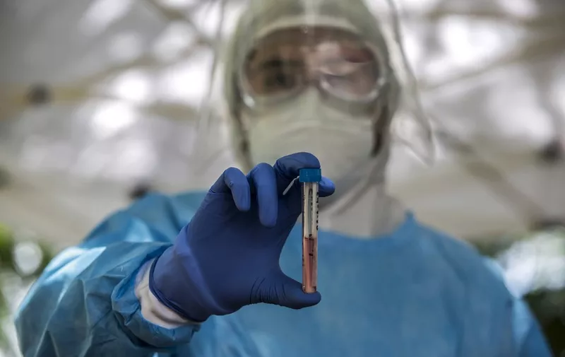 A health worker shows a swab sample for a COVID-19 test, in Merida, Yucatan state, on July 24, 2020, amid the novel coronavirus pandemic. (Photo by HUGO BORGES / AFP)