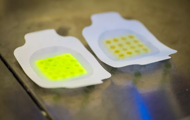29112 Toby Jenkins and Infection Bandages 11 Nov 2016. Toby and Thet (Naing Thet), discuss the infection detecting colour-changing dressings they are developing in the lab. Clinical trials are about to commence. The dressing fluoresces under UV light in the presence of infections.  Client: Chris Melvin - Corp Comms