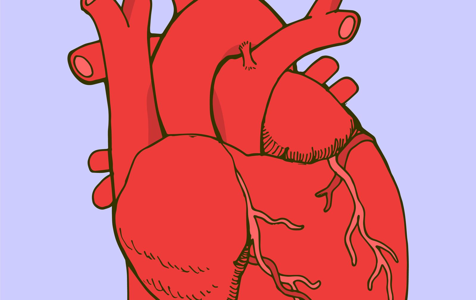 Srca seks infarkt i Tri glavna