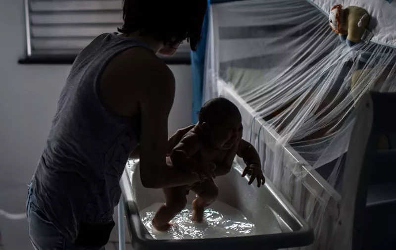 Kleisse Marcelina ,24, bathes her son Pietro, 2 month, suffering from microcephalia caught through an Aedes Aegypti mosquito bite, in Salvador, Brazil on January 28 , 2016. AFP PHOTO / Christophe SIMON / AFP PHOTO / CHRISTOPHE SIMON